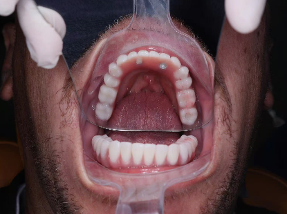 Australian Dental Tourism